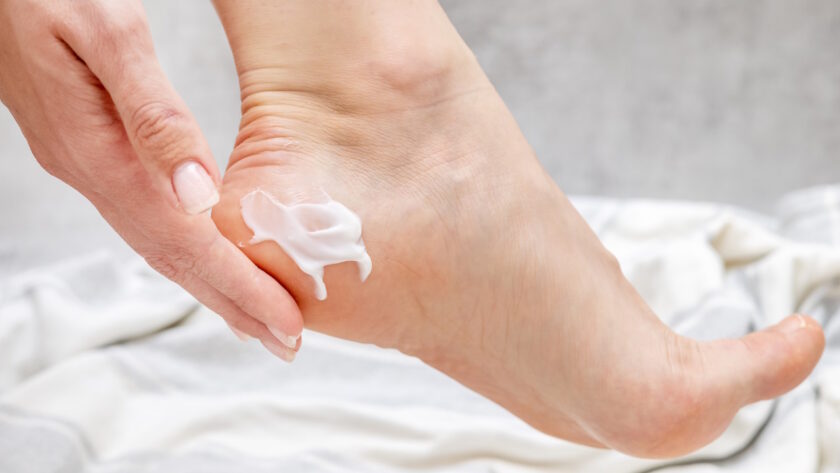 krem na zrogowacenia dzialanie